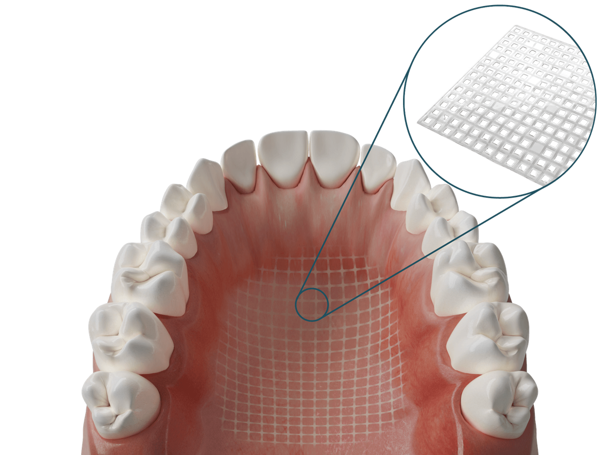 Dentapreg® MESH Transparent – Dentapreg - ADM, a.s, Prothesenkunststoffe