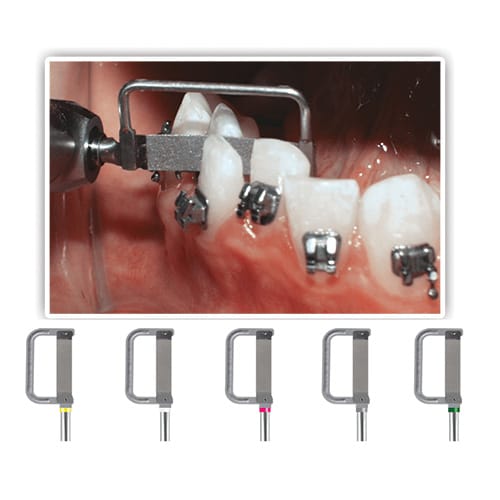 DYNAFLEX RECIPROCATING IPR SYSTEM - SINGLE SIDED