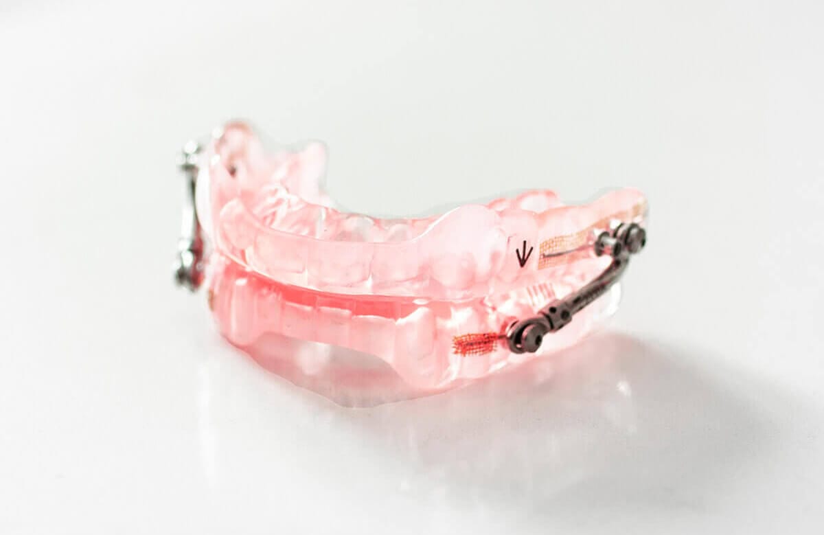 Respire Pink Micro – Dynaflex Orthodontics USA, Sonstige Schienen
