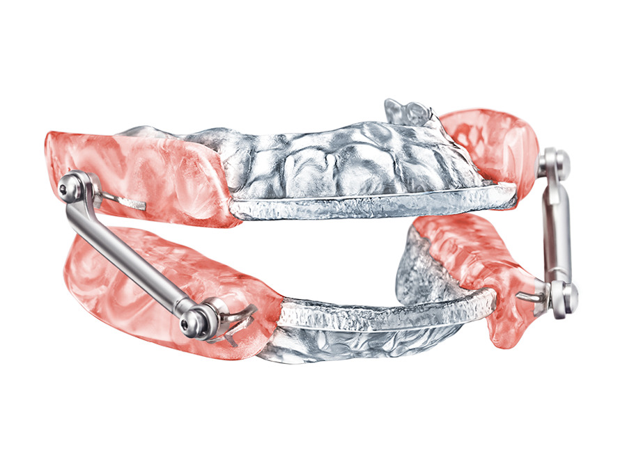 Respire Pink EF AT (Advanced Titration) – Dynaflex Orthodontics USA, Sonstige Schienen
