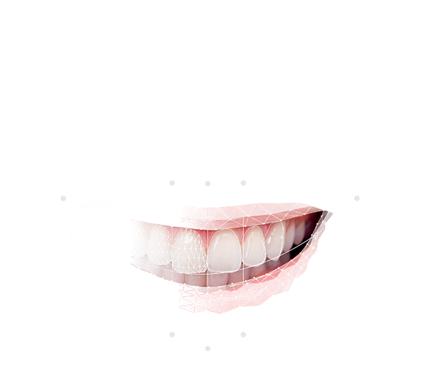 Smile Creator – Exocad, CAD/CAM-Software