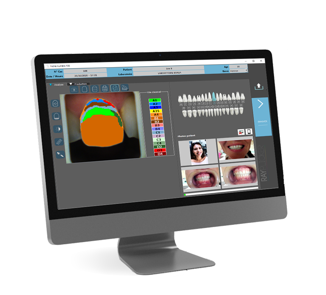 Software Rayplicker versión antigua – Borea, CAD/CAM-Software