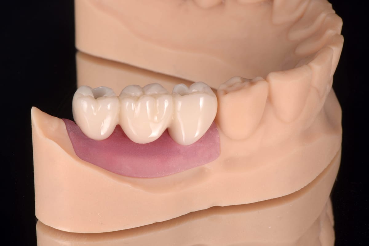 DH Print Provisorium CB – Denken-Highdental Co., Ltd., Druckharze