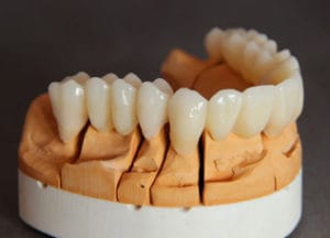 Dentalos Plus SG1a – DentalPlus, Kunststoffe