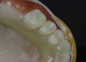 Dentalos Plus Mono Blanks