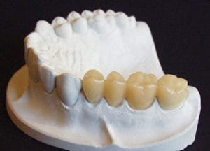 Dentalos Plus SG6a – DentalPlus, Kunststoffe