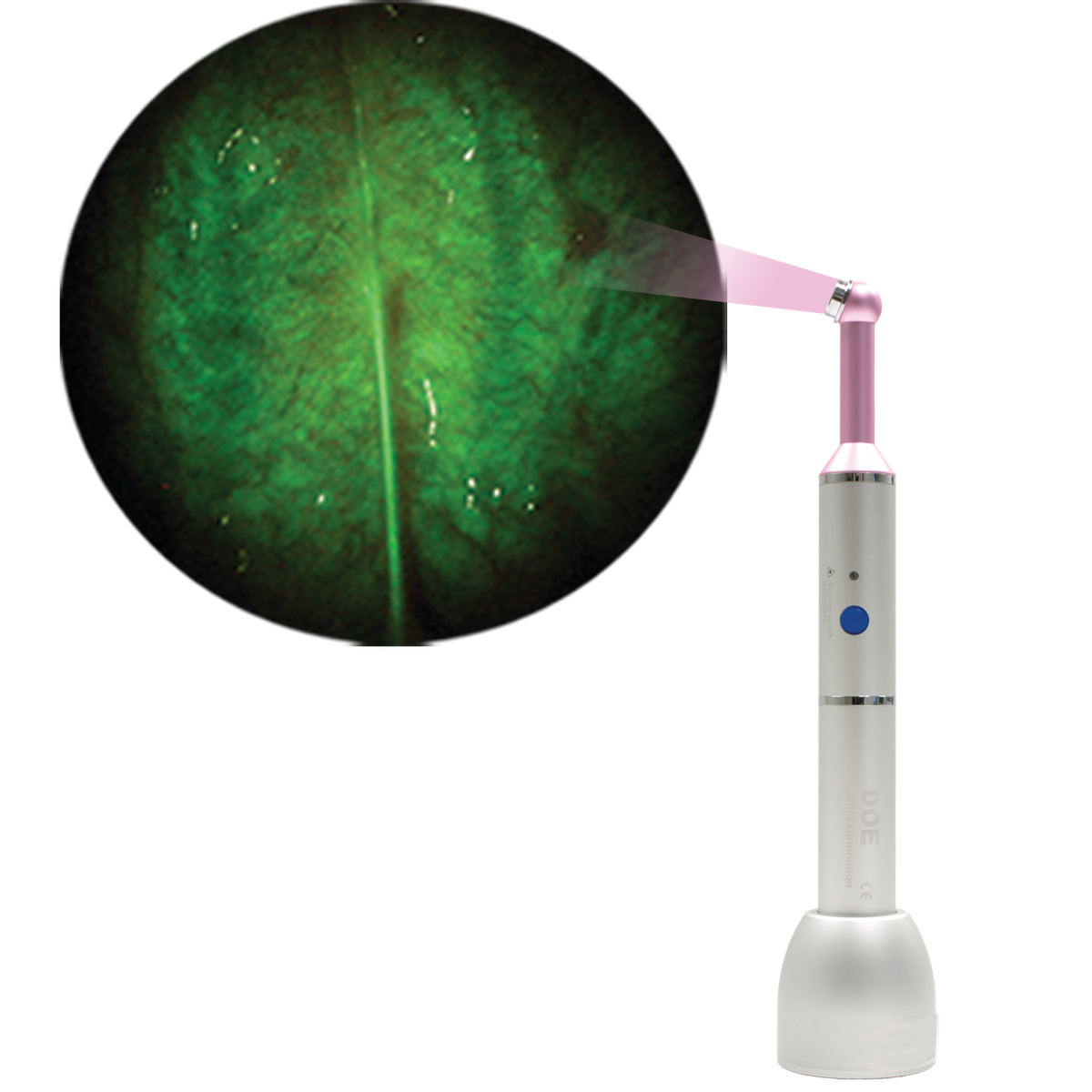 DOE SE - DentLight – DentLight Inc., Intraorale Kameras