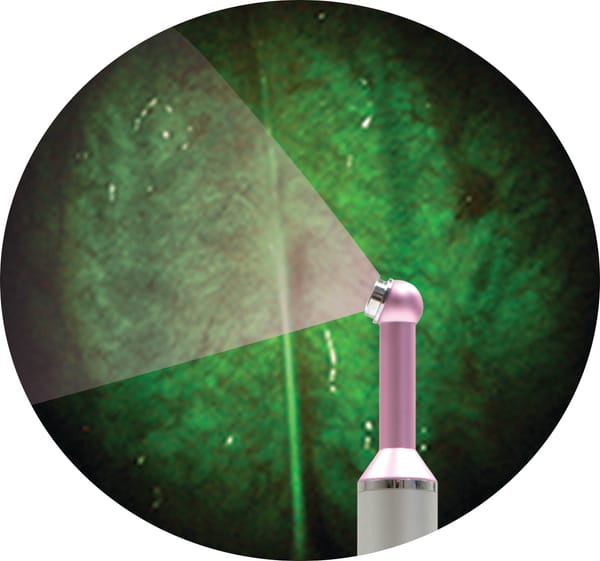 DentLight FUSION DOE – Gerät zur Munduntersuchung und Karieserkennung