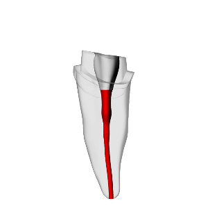 Incisor – Prepared crown, Clear