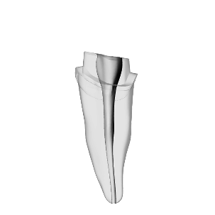 Incisor – Prepared crown, Shaped, White