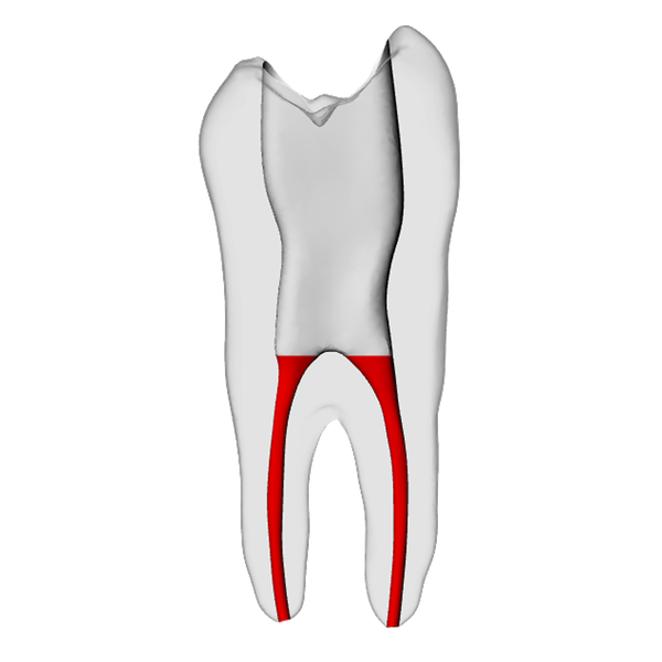 Premolar – Accessed, Basic, Radiopaque (White)