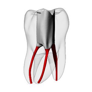 Molar – Accessed, Basic, Clear, ~20#