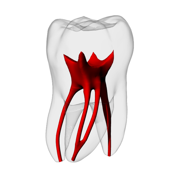 Molar – Merging MB2, Radiopaque (White)