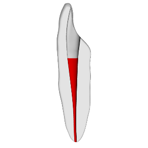 Incisor – Accessed, Basic, Clear, ~20#