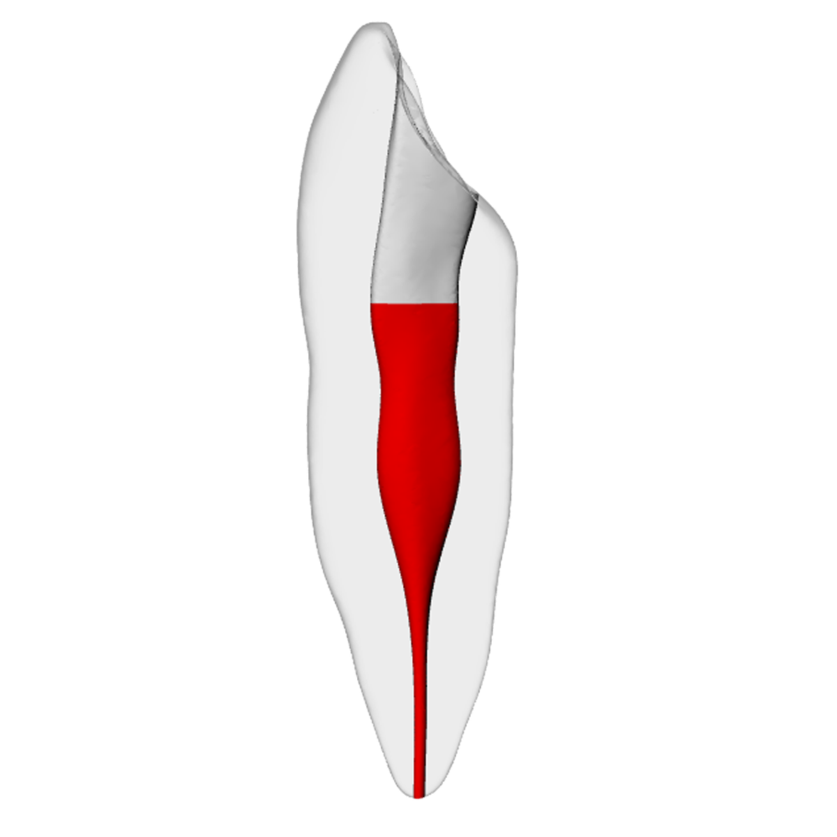 Canine – Accessed, Basic, Radiopaque (White) – DRSK Group AB, Zubehör für Wurzelbehandlung