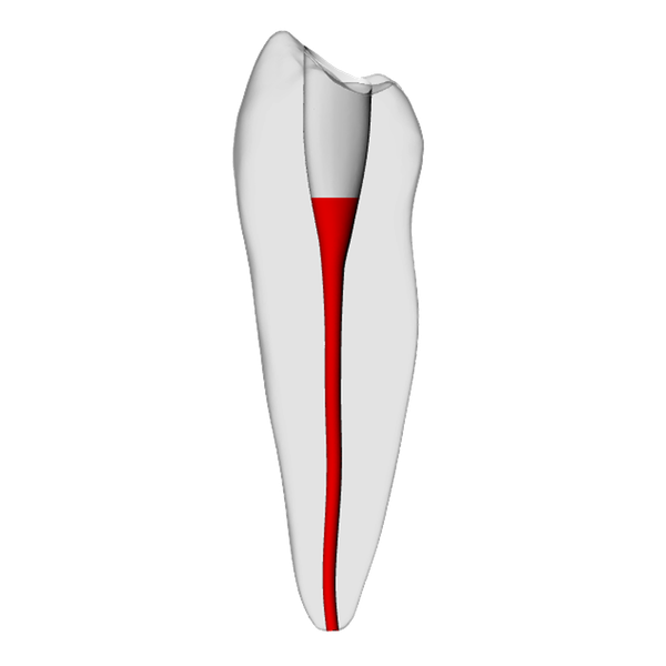 Premolar – Accessed, Basic, Clear, ~20#