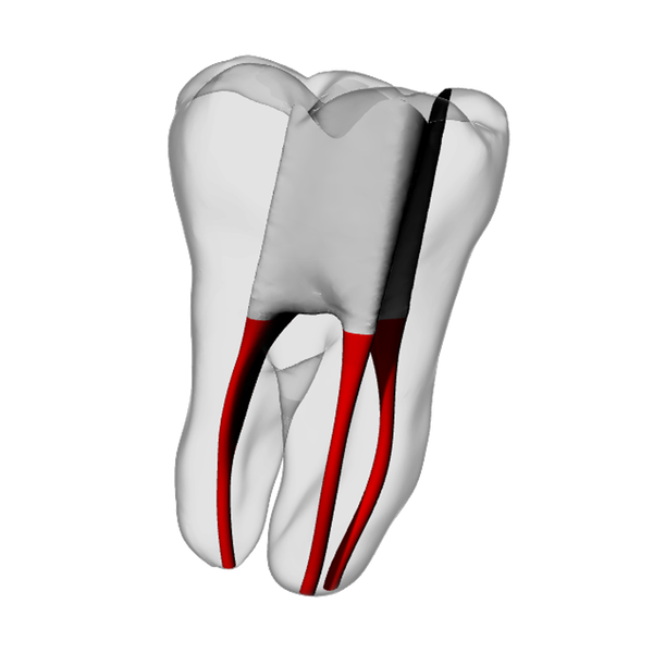 Molar – Accessed, Basic, Clear