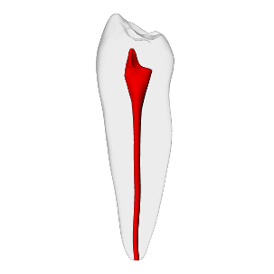 Premolar – Basic, Clear Root, White Crown, ~20#
