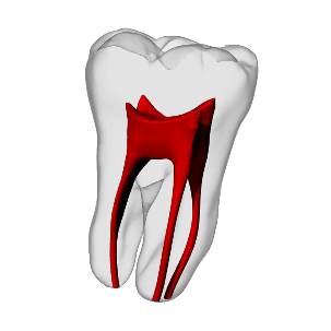 Molar – Basic, Clear Root, White Crown – DRSK Group AB, Demomodelle