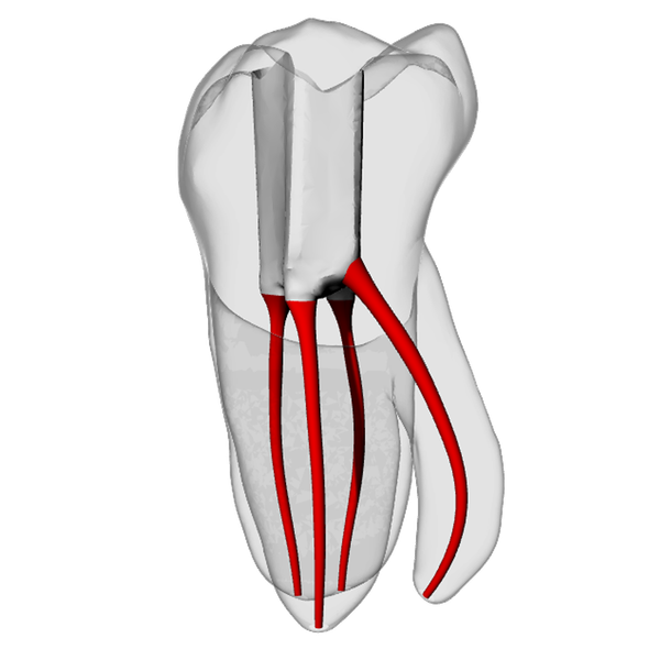 Molar – Radix entomolaris