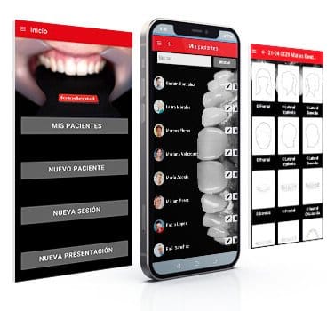 Fotodental Smartphone-App