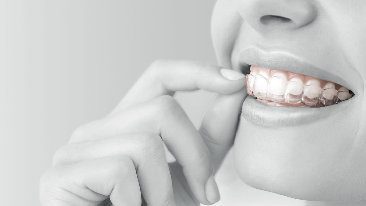 GT FLEX Clear Aligner & Retainer Material – GOOD FIT TECHNOLOGIES LLC, Kieferorthopädie