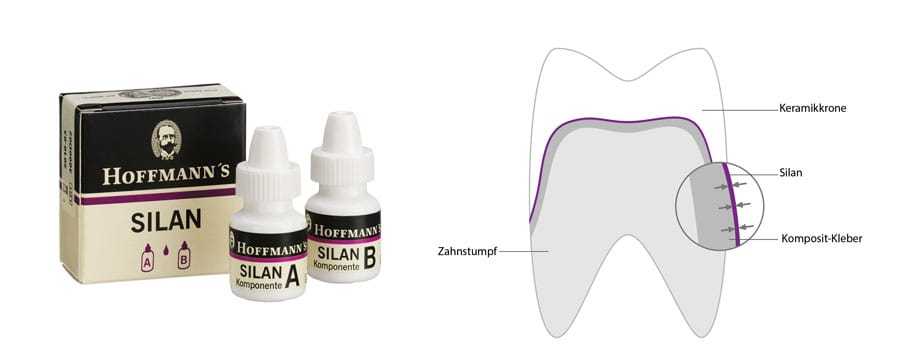 Hoffmannʼs 硅烷 – Hoffmann Dental Manufaktur, Adhäsive (Bonding)
