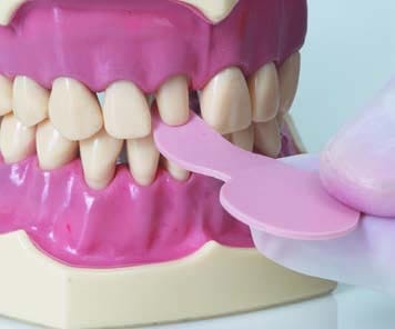 Bausch Fleximeter-Strips 1,0 mm rot