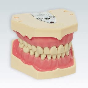 AG-3 28 Ober- und Unterkiefermodell