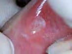 mirafluor-gel strawberry