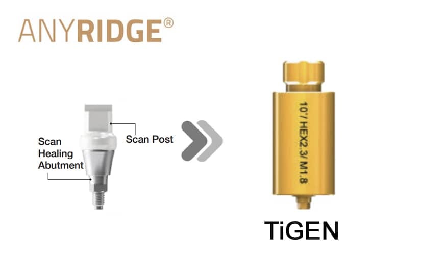 AnyRidge SHA TiGEN(Pre-milled) – MegaGen F.D. GmbH, CAD/CAM-Software