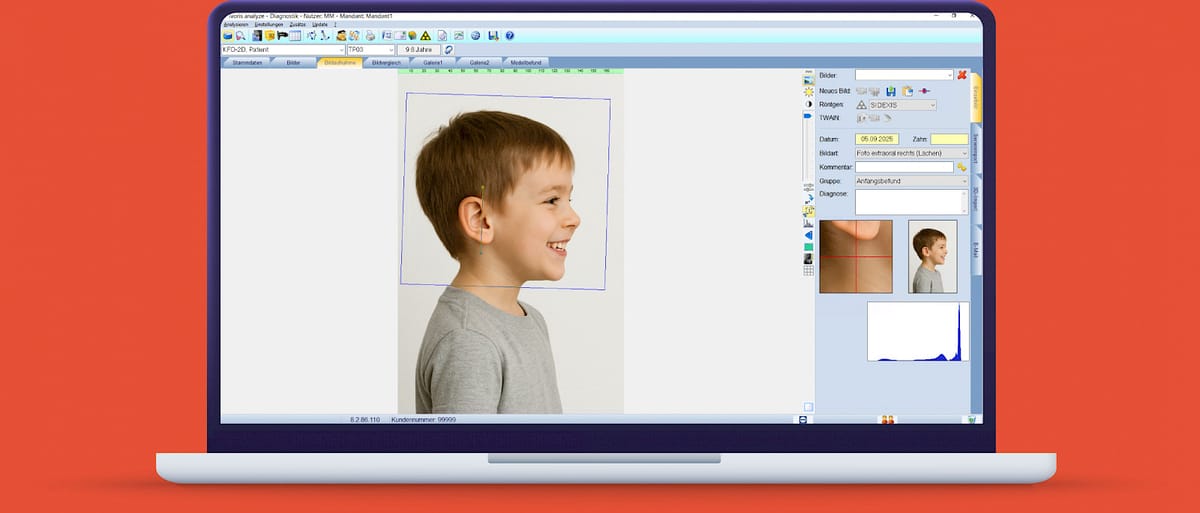 ivoris® analyze express – Computer konkret, CAD/CAM-Software