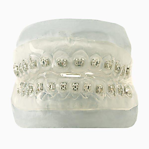 Elasto Aligner Ower Brackets EL/01