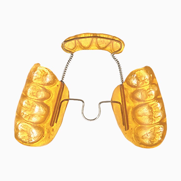 Inman Bonded Crossbite Expander EX/13 – lab3d, Sonstige Schienen