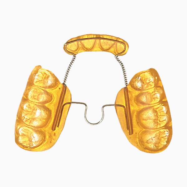 Inman Bonded Crossbite Expander EX/13