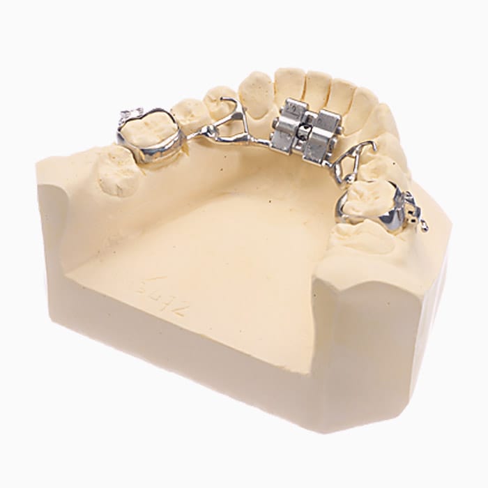 Fixed Transverse Expander EX/14 – lab3d, Klasse-II-Apparaturen