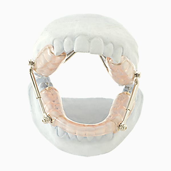 Acrylic Splint Herbst HE/02