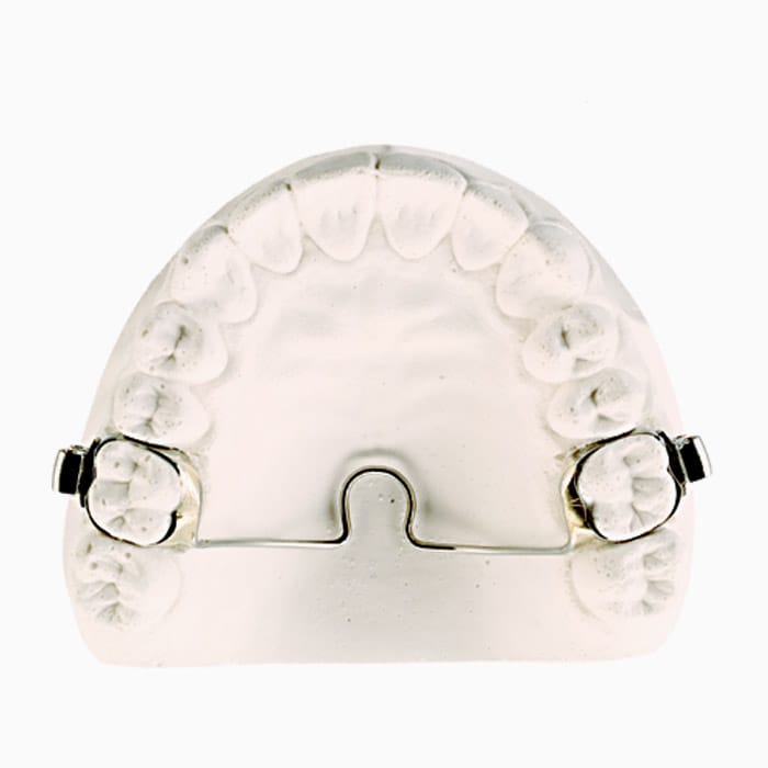 Fixed Transpalatal Arch HO/01 – lab3d, Sonstige Schienen