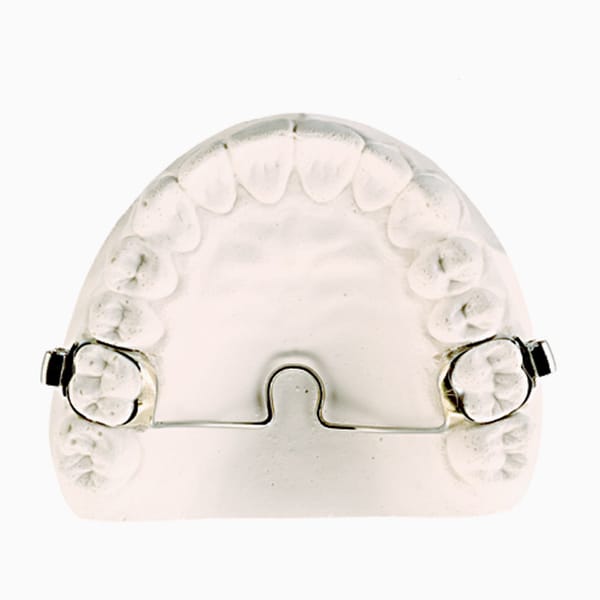 Fixed Transpalatal Arch HO/01