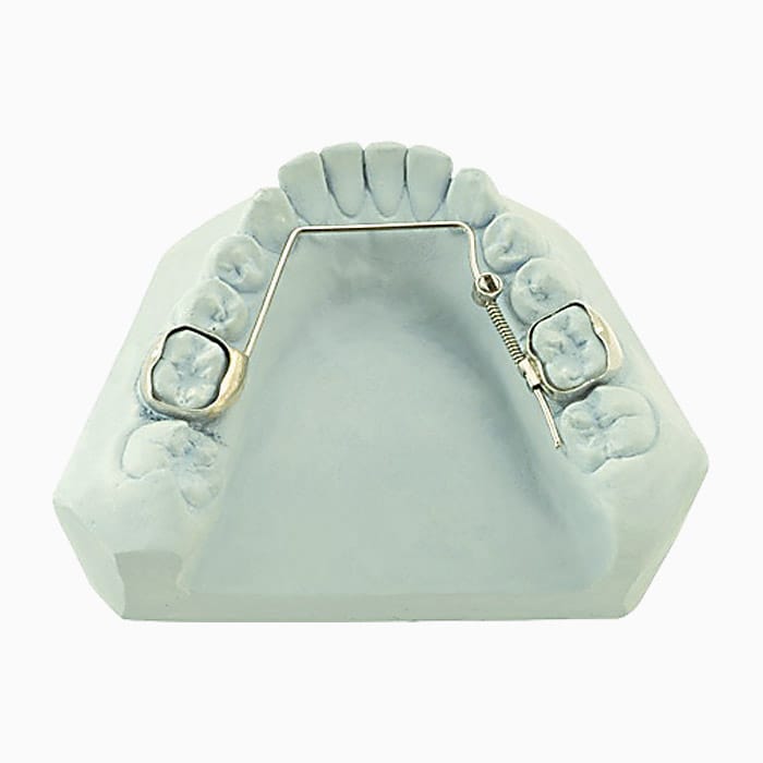 Arch Expander MD/14 – lab3d, Sonstige Schienen