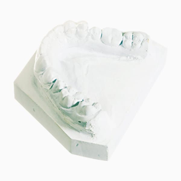 Bonded Retainer RA/11