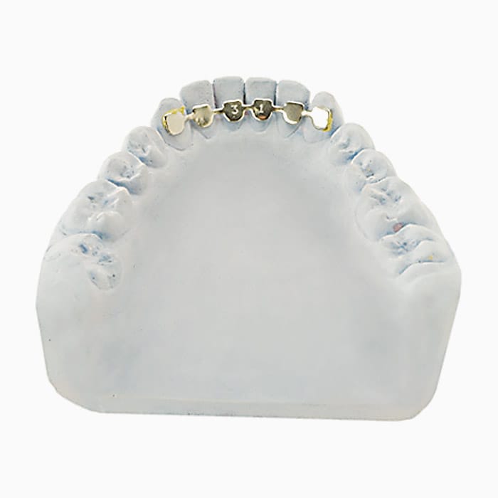 3x3 Fixed Retainer RA/12 – lab3d, Sonstige Schienen