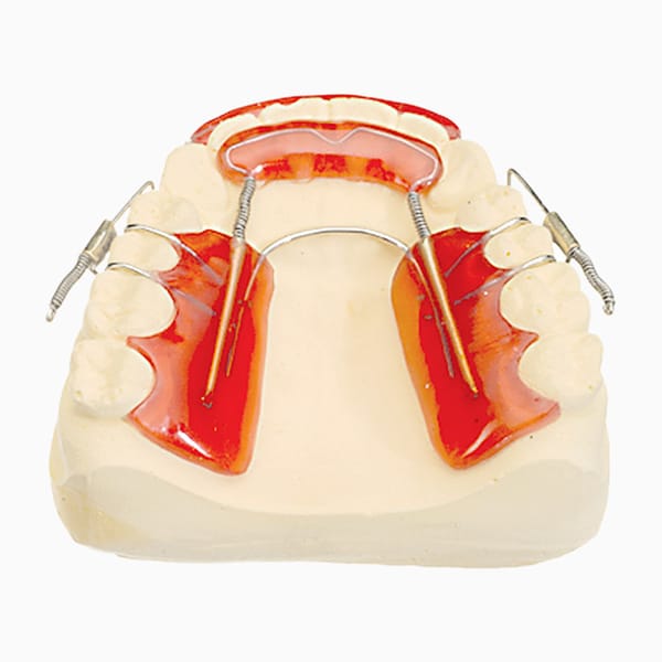 Inman Aligner RA/02