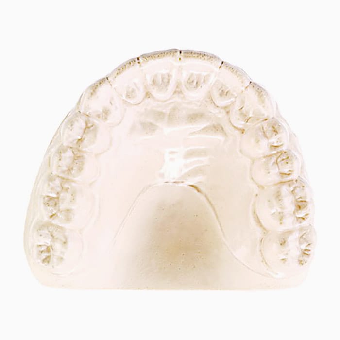 Invisible Retainer SP/08 – lab3d, Sonstige Schienen