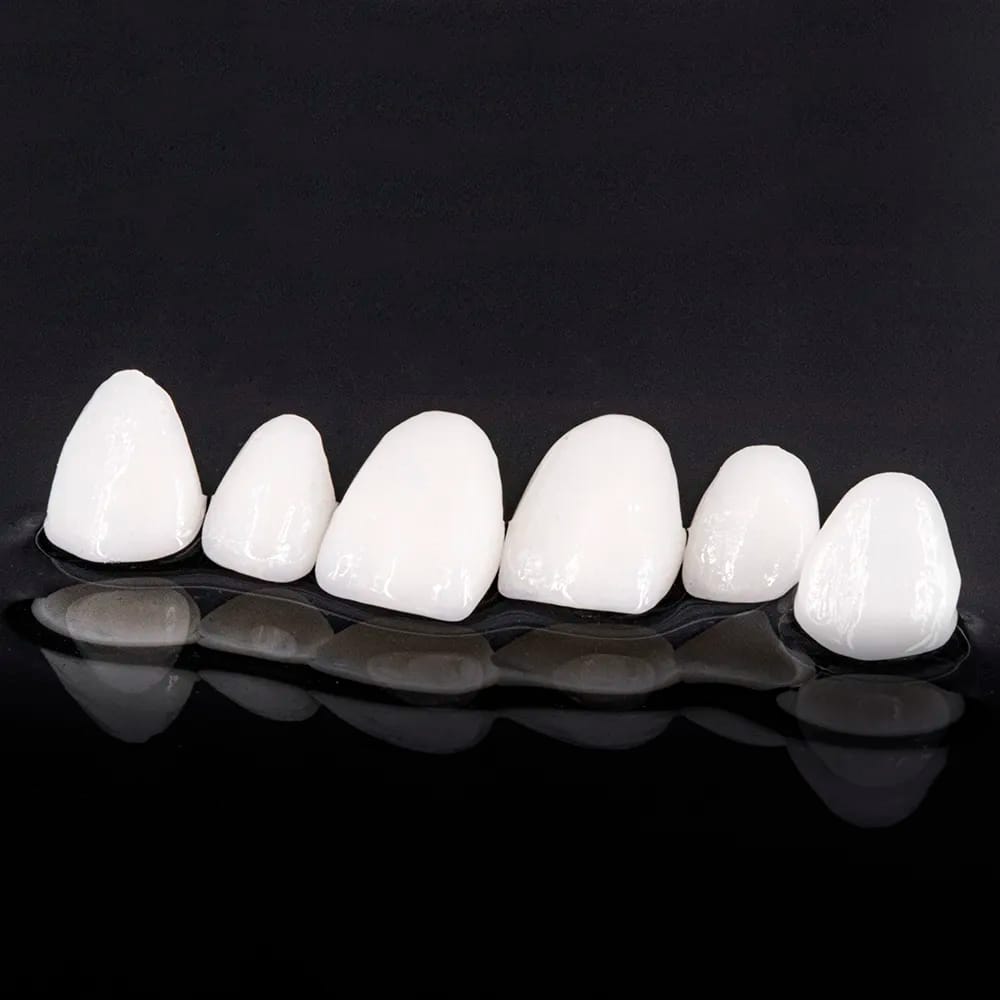 Monolithic Laminate Ivoclar Press CA/21i – lab3d, Lithium-Disilikat