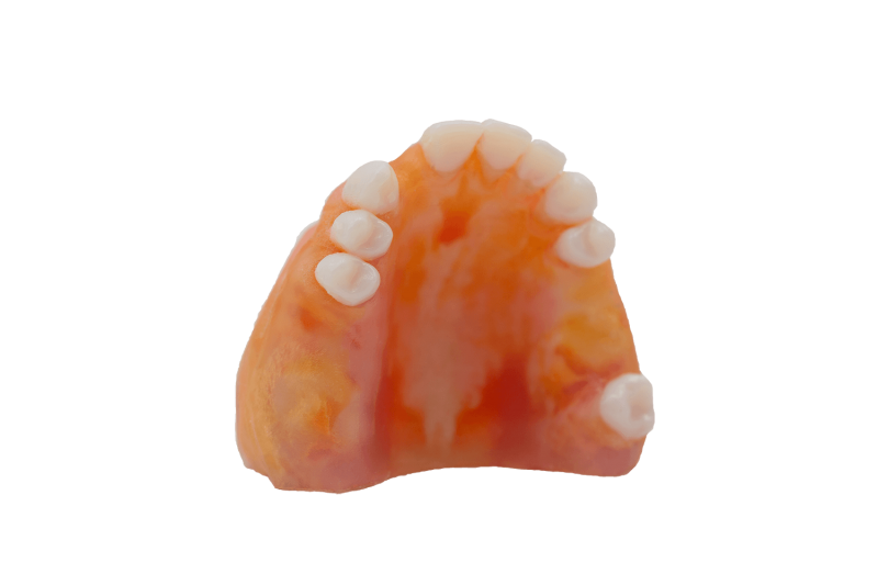 TrueJaw Implant Maxilla – PlanB Dental, Demomodelle
