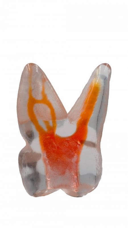 TrueTooth - Molar – PlanB Dental, Druckharze