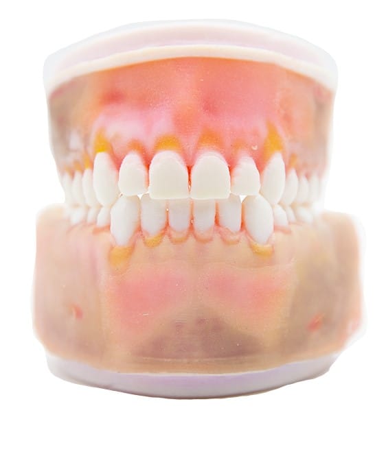 TrueJaw Endochirurgie – PlanB Dental