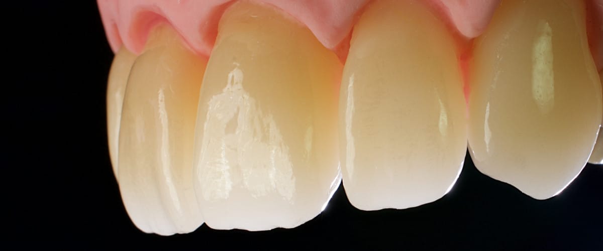 priti®multidisc ZrO2, Multi Translucent PLUS – Pritidenta GmbH, Zirkonoxid