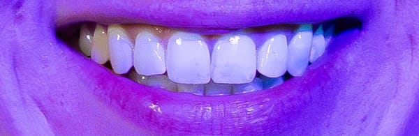 priti®perfect Glaze Extra Fluo